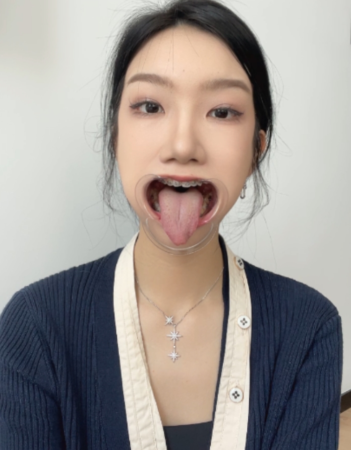 恋物癖口腔舌头喉咙视频系列：永久有效，双层压缩