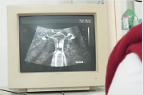 购买带B超仪的老婆看到的神秘东西