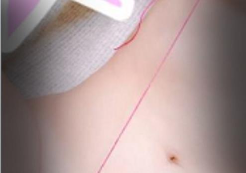 Myo-Via精选教育师猎奇视图：豆豆晶莹剔透，女生男人头头生物学功能退化另类！